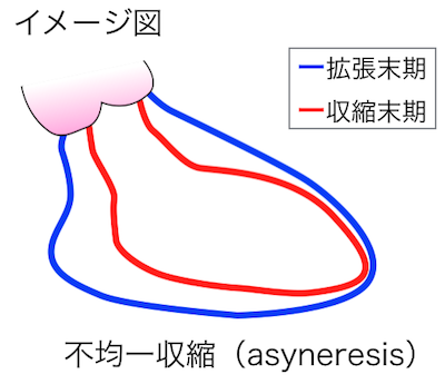 不均一収縮（asyneresis）