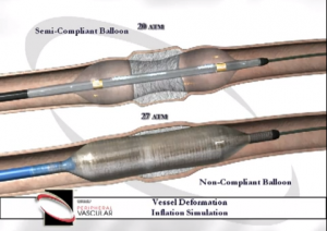 ドッグボーン現象