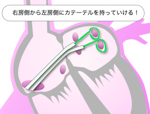 ブロッケンブロー　効果