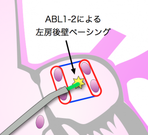 BOX Isolation end point