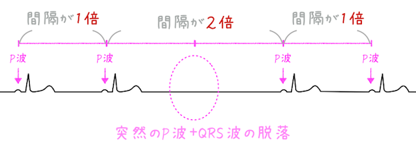 洞房ブロック sss2